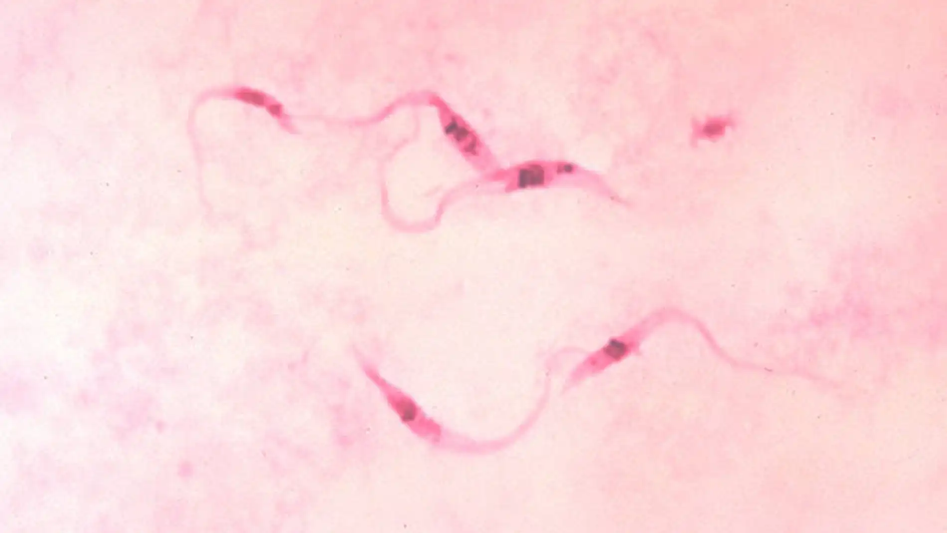 El llamado Mal de Chagas es una enfermed