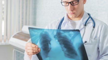 Un médico mira una radiografía de un pac