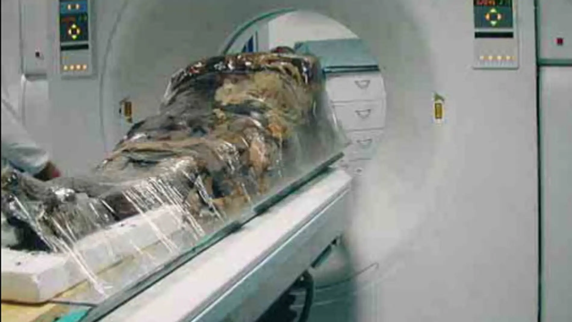 La momia de Cangrande analizada en Pisa