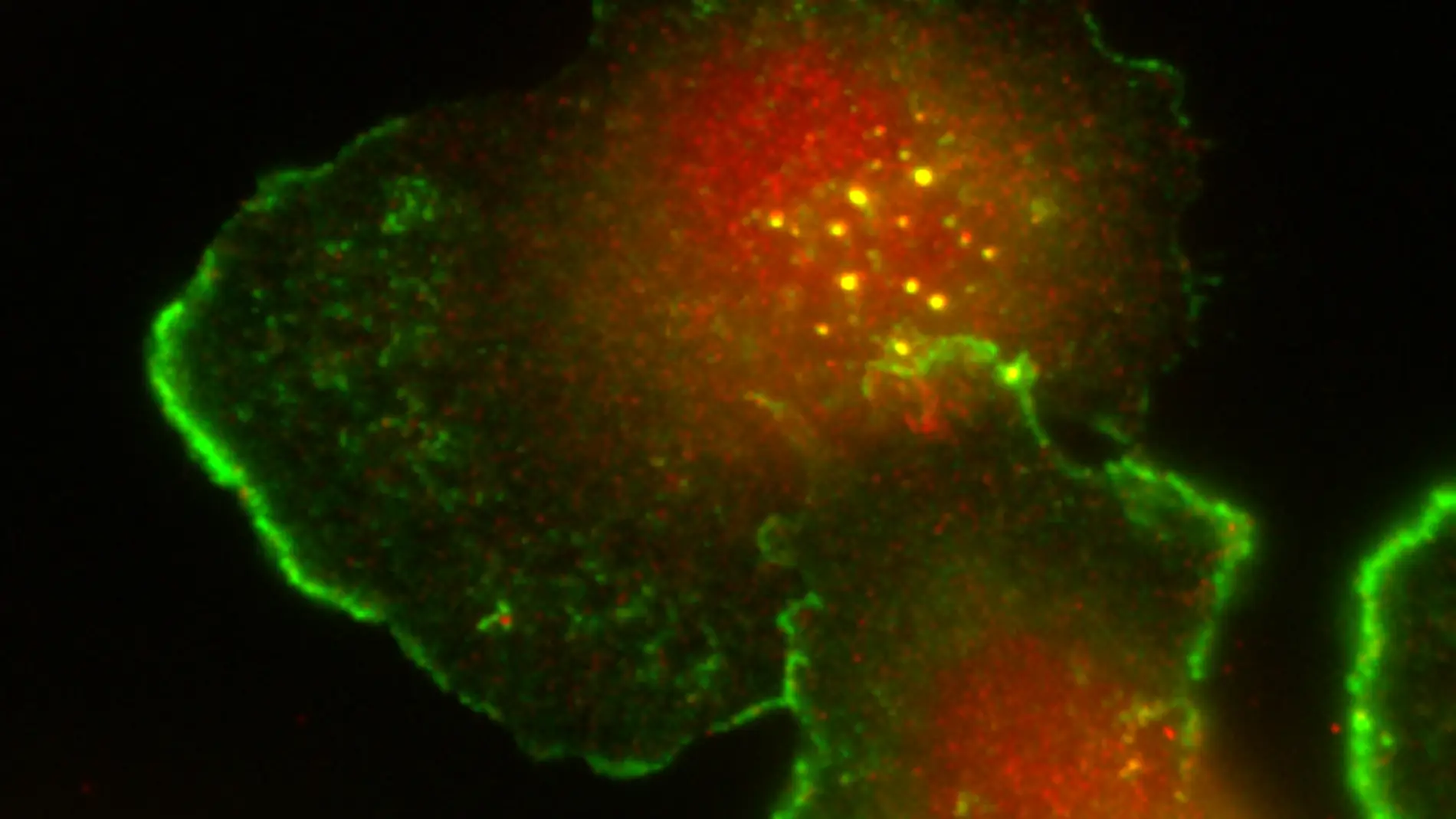 Células tumorales humanas de cáncer de m