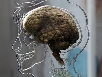 ¿Por qué nuestro cerebro es tan grande? ¿Por qué nuestro cerebro es tan grande?