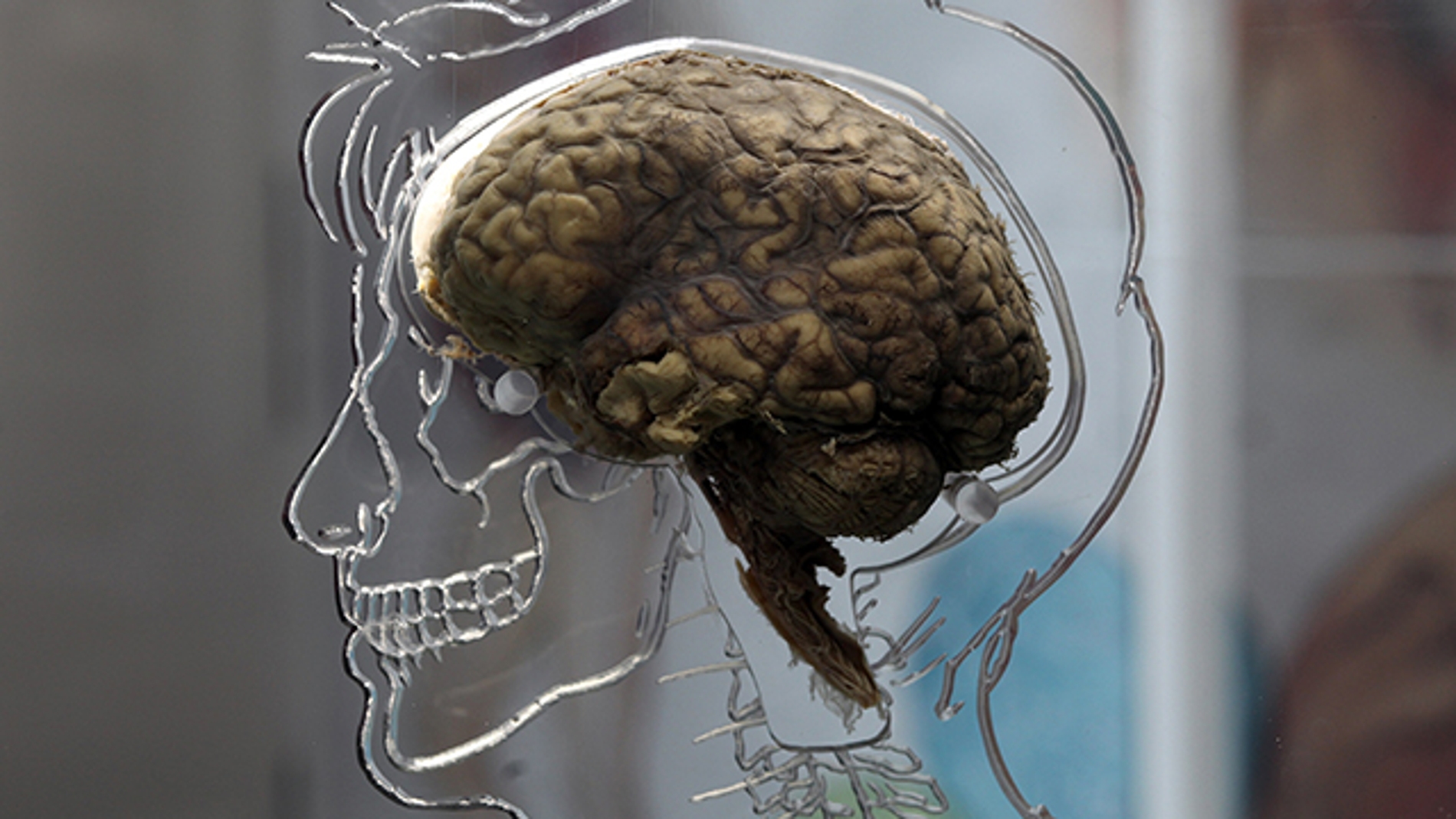 ¿Por qué nuestro cerebro es tan grande?