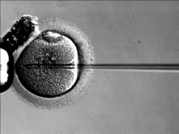 Inseminación artificial Inseminación artificial