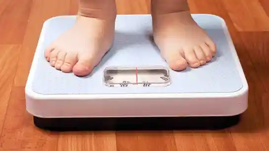 Obesidad Obesidad