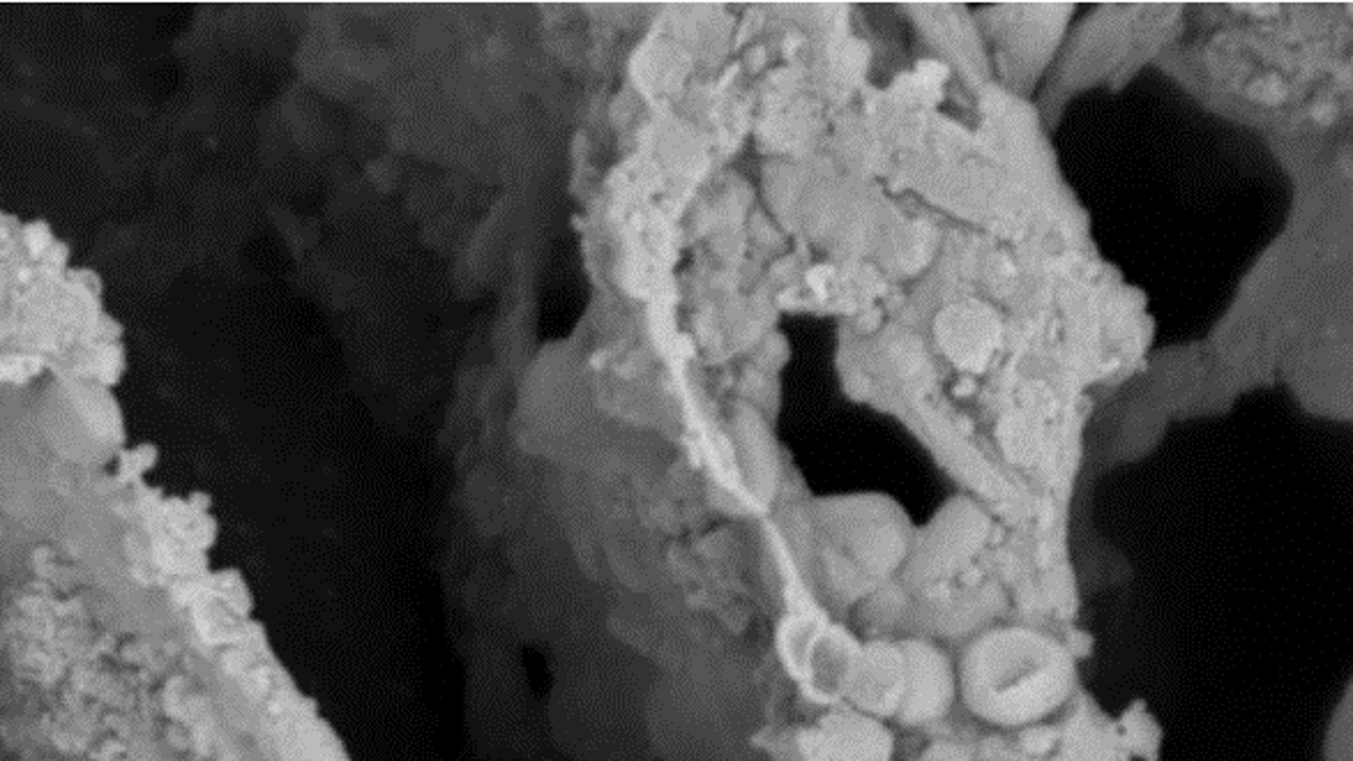 Muestra de microbiota de heces de un ind