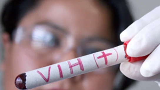 Muestra de VIH en un laboratorio Muestra de VIH en un laboratorio