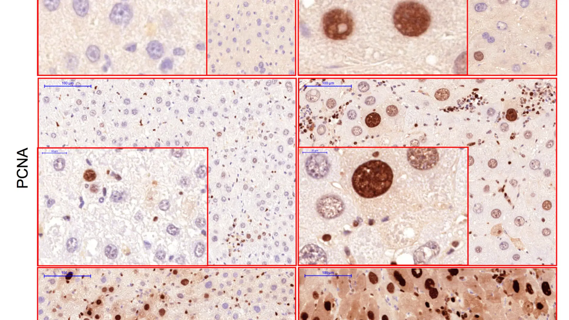 imagen CNIO - células hepáticas
