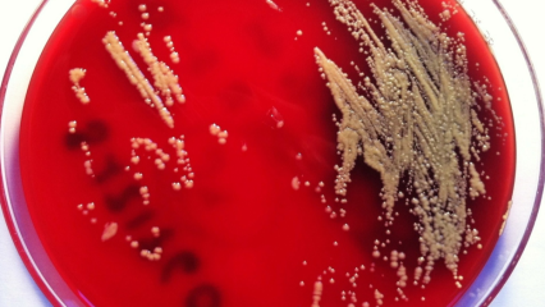 Hasta ahora la bacteria había sido exclu