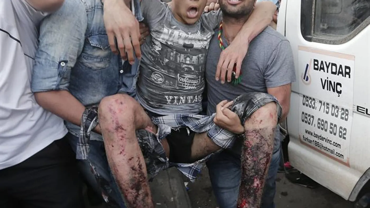 Dos muertos y 100 heridos en Turquía por una explosión en un mitin Dos muertos y 100 heridos en Turquía por una explosión en un mitin