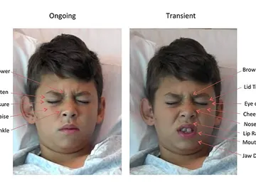 ¿A tu hijo le duele algo? Este software te dice cuánto ¿A tu hijo le duele algo? Este software te dice cuánto
