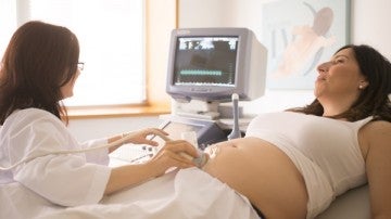 La endometriosis es la presencia de célu