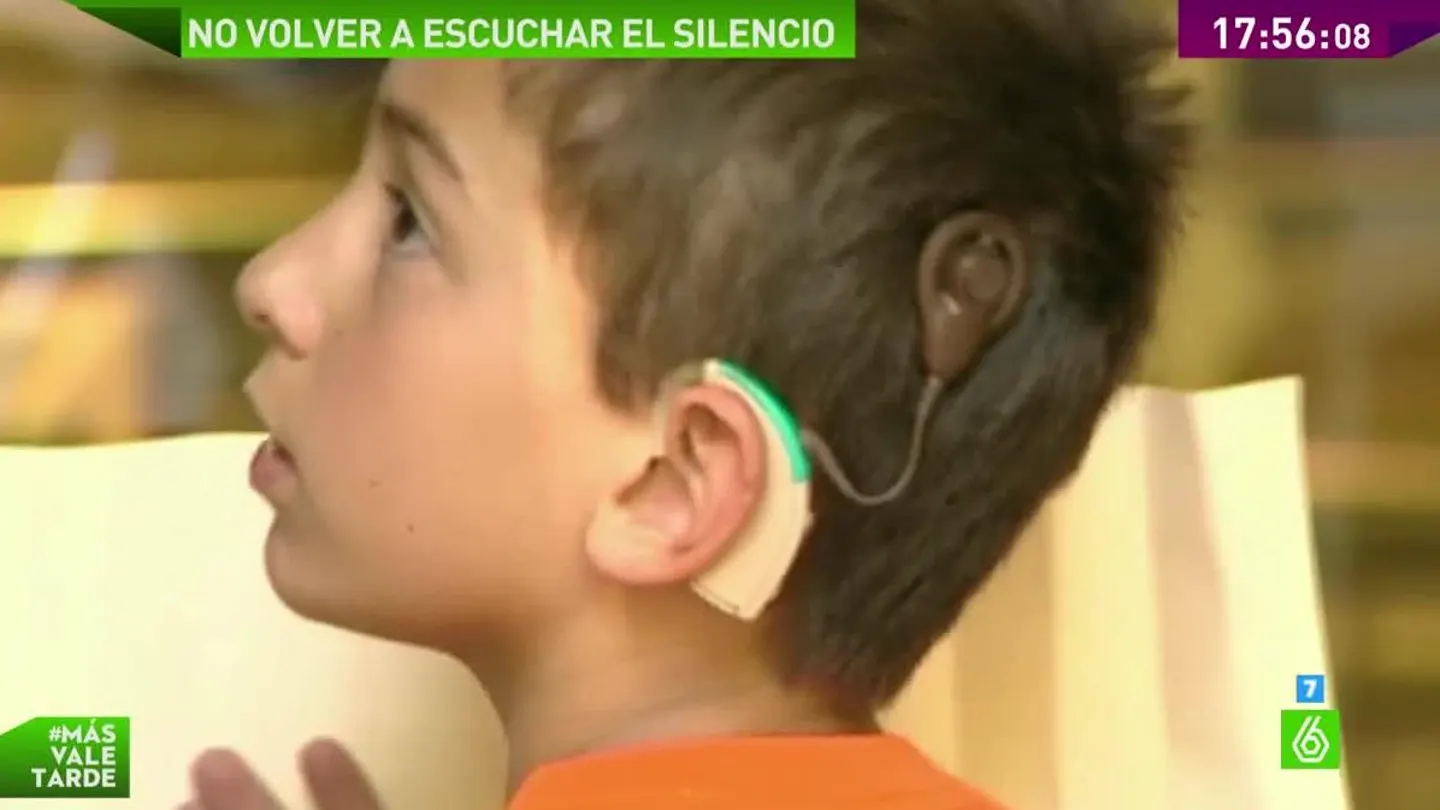 13.500 personas usan implantes cocleares 13.500 personas usan implantes cocleares