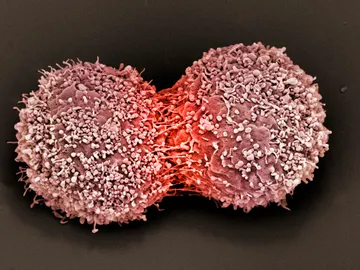 Descubren que la quimioterapia podría generar células cancerígenas Descubren que la quimioterapia podría generar células cancerígenas