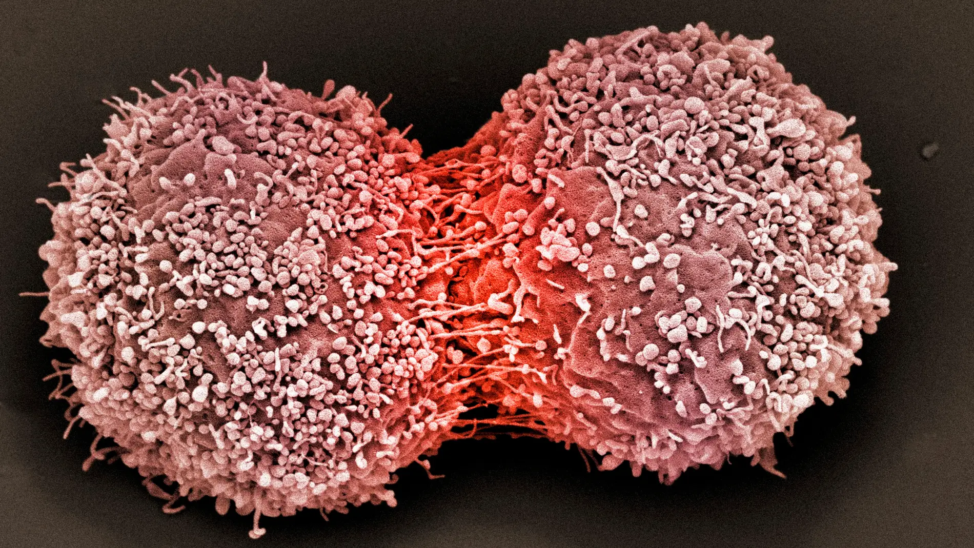 Descubren que la quimioterapia podría generar células cancerígenas 