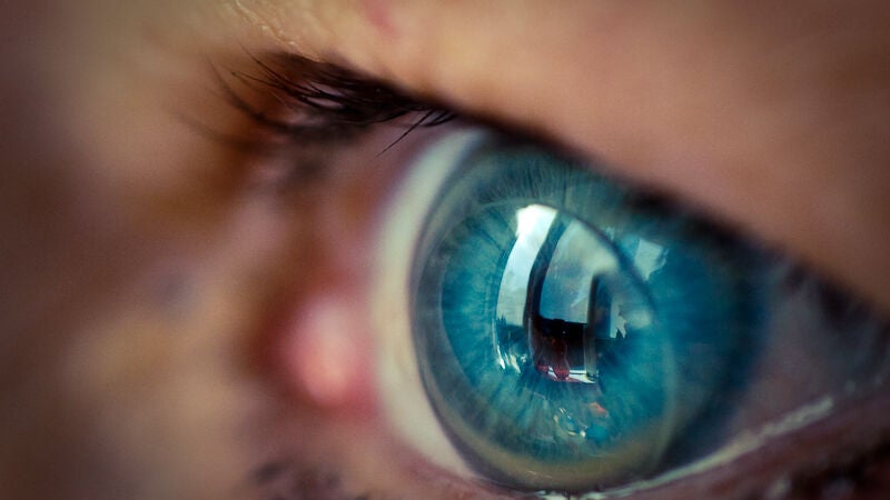 Una mujer descubre que lleva 28 años con una lentilla incrustada en el ojo