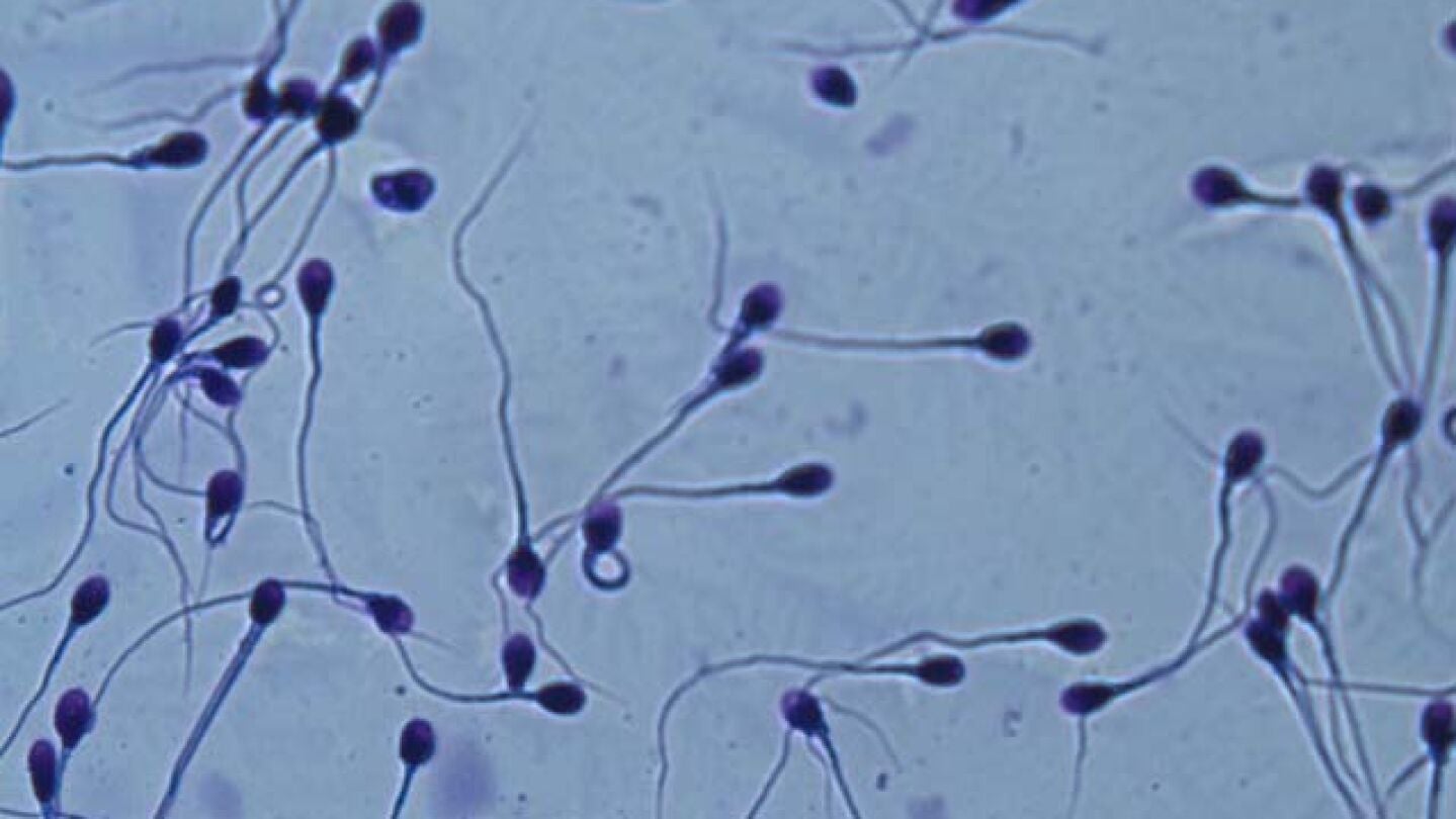 Espermatozoides en el microscopio.