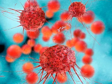 Las células cancerosas flotan por encima de las sanguíneas más densas Las células cancerosas flotan por encima de las sanguíneas más densas