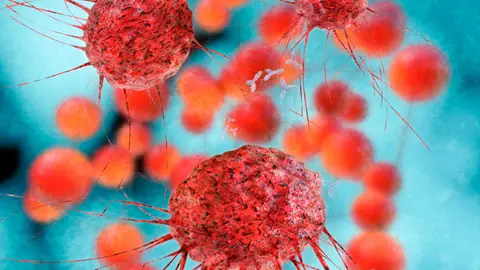 Las células cancerosas flotan por encima de las sanguíneas más densas