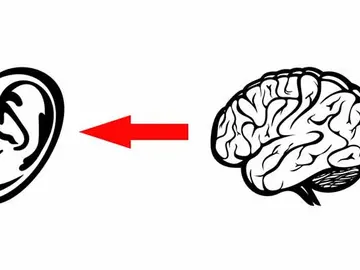 Eso que escuchas no es real, porque el cerebro inventa sonidos Eso que escuchas no es real, porque el cerebro inventa sonidos