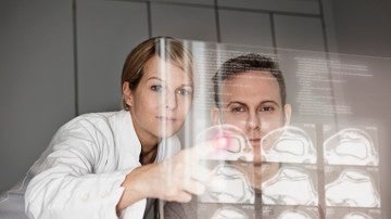 El cerebro femenino es más vulnerable al Alzhéimer
