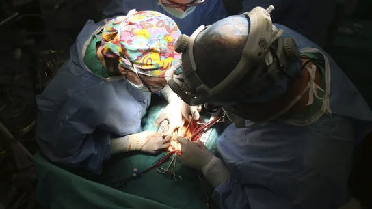 Imagen de un quirófano durante un trasplante de corazón Imagen de un quirófano durante un trasplante de corazón