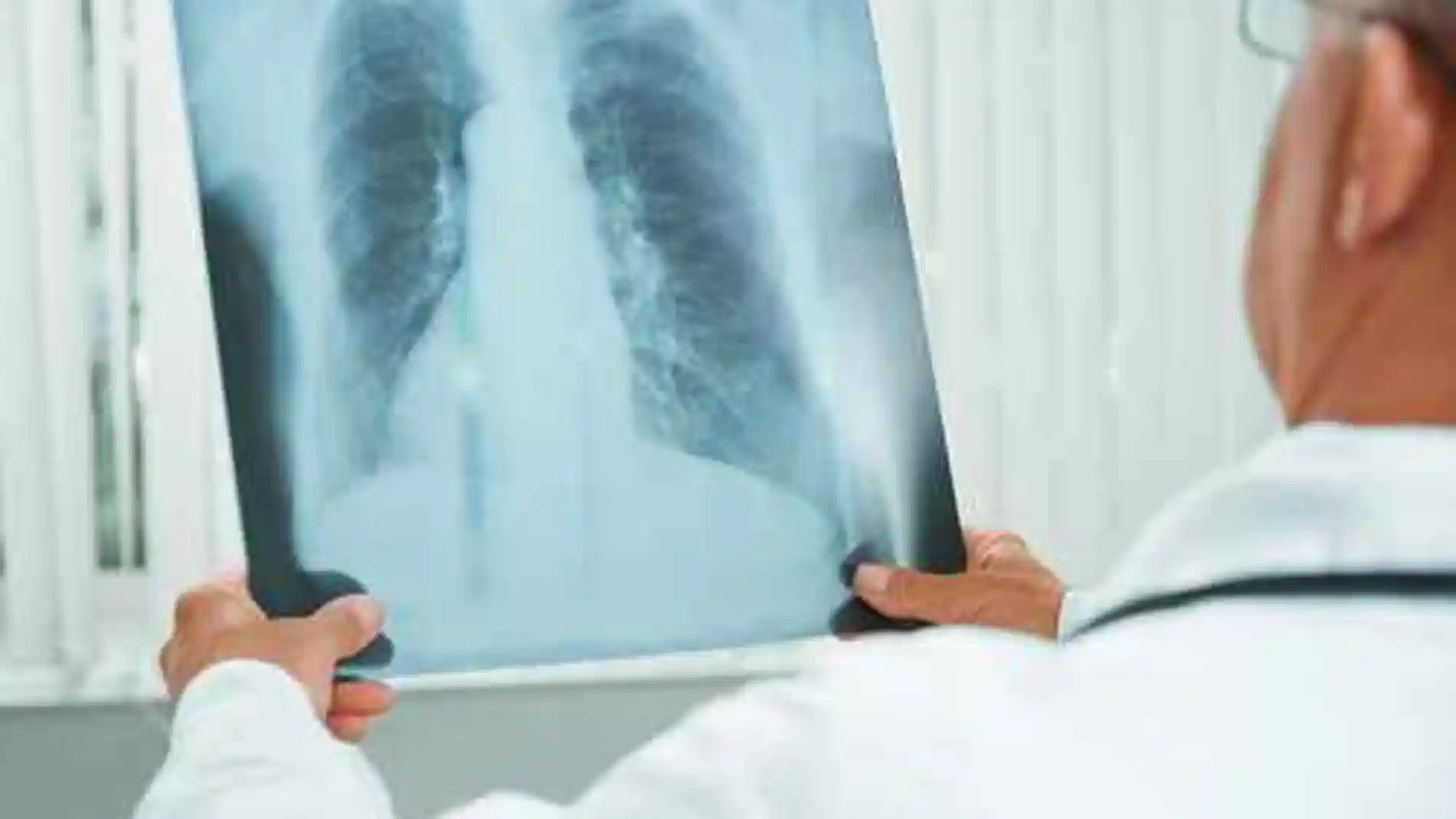 La hipertensión pulmonar es una enfermed