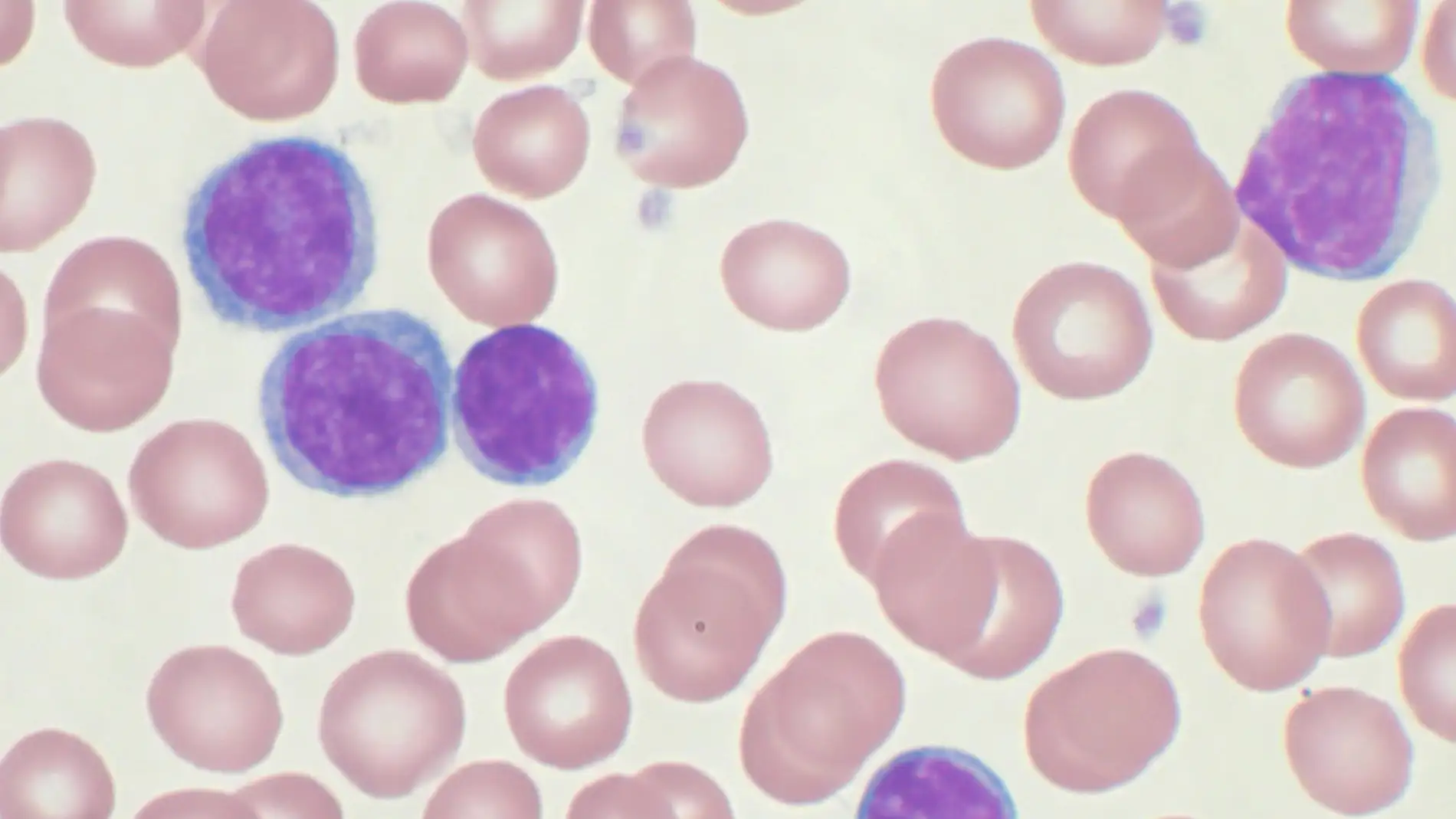 Microarray desarrollado por qGenomics