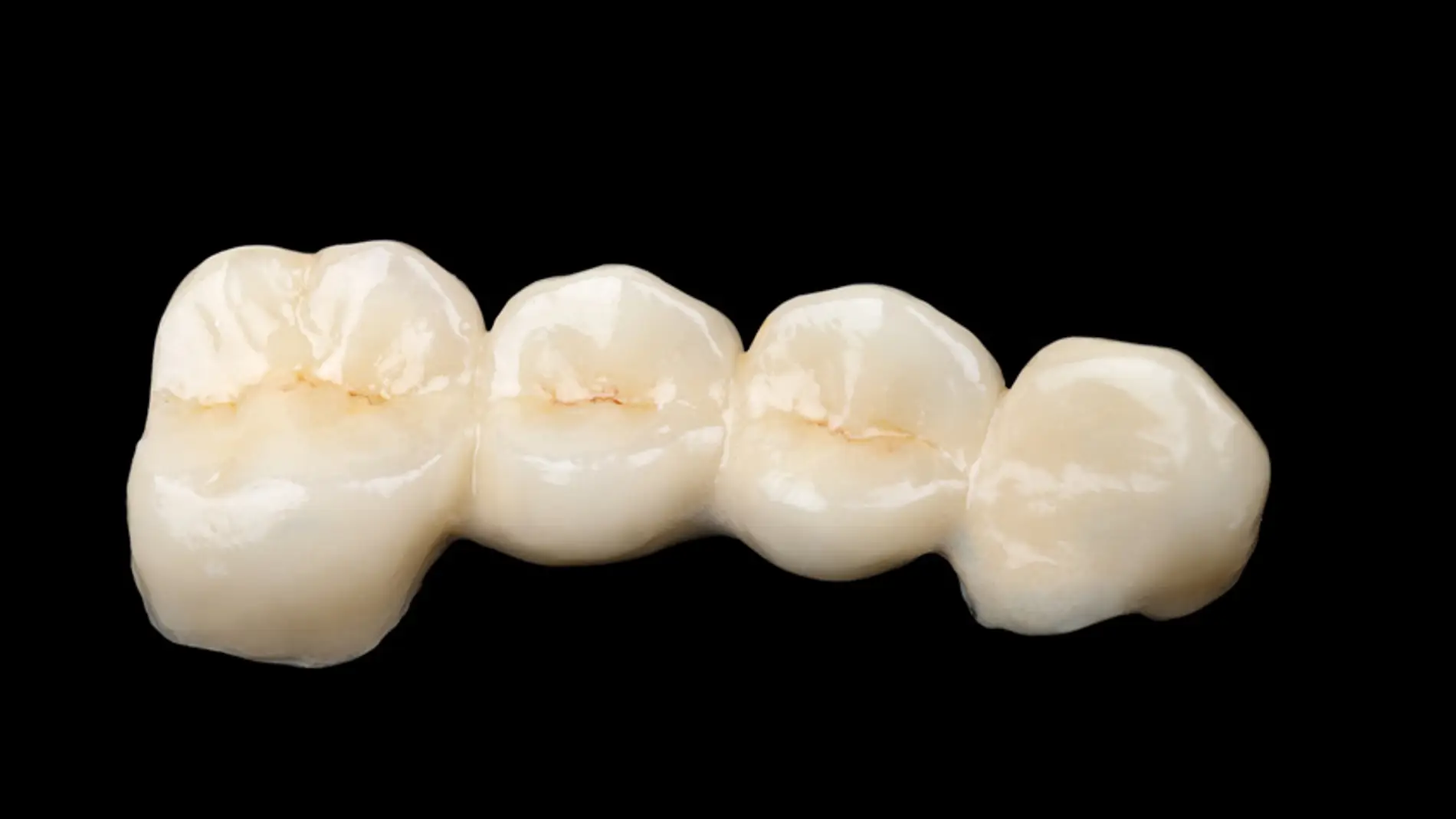 El esmalte que recubre nuestros dientes