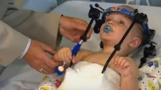 Jaxon Taylor, de 16 meses, tras ser operado de una 'decapitación interna' Jaxon Taylor, de 16 meses, tras ser operado de una 'decapitación interna'