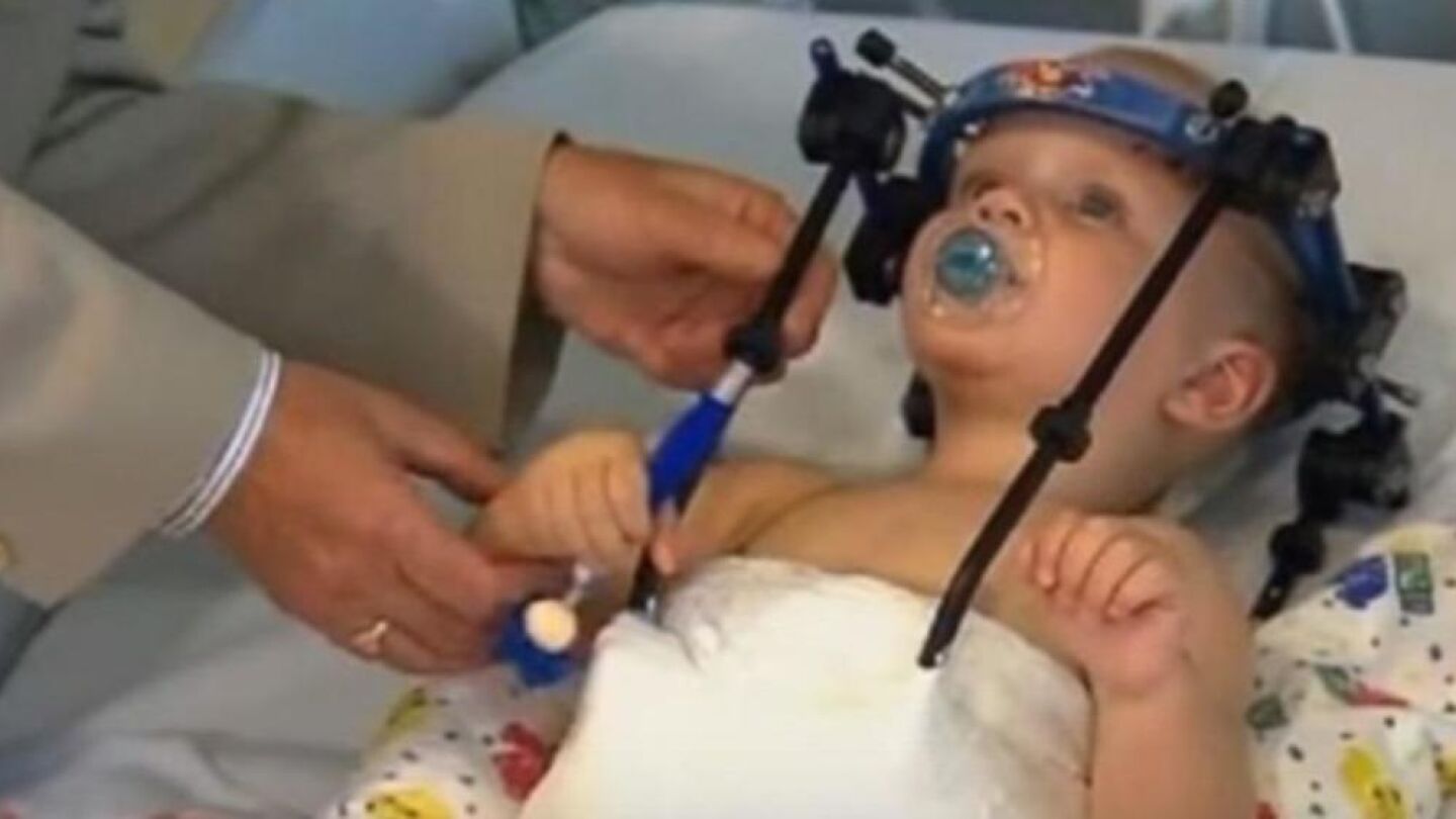 Jaxon Taylor, de 16 meses, tras ser operado de una 'decapitaci&oacute;n interna'