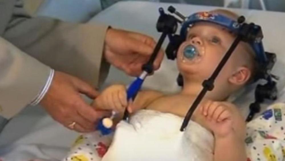 Jaxon Taylor, de 16 meses, tras ser operado de una 'decapitación interna'