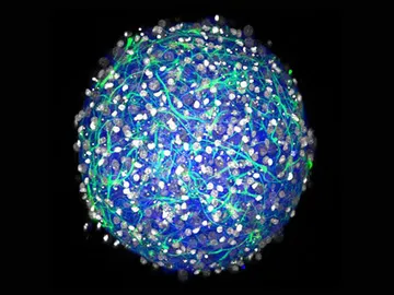 Cómo crear un mini cerebro Cómo crear un mini cerebro