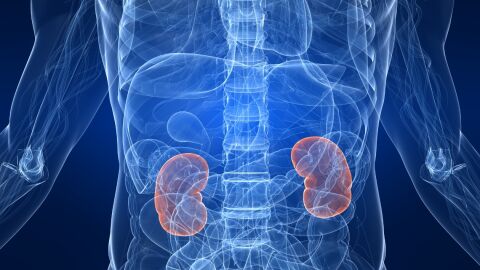 Piedras en el riñón