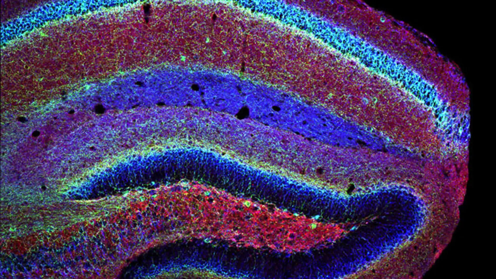 El receptor de cannabinoide CB1, en el