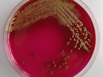 Un científico ruso se auto-inyecta una bacteria de 3,5 millones de antigüedad