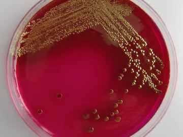 Un científico ruso se auto-inyecta una bacteria de 3,5 millones de antigüedad Un científico ruso se auto-inyecta una bacteria de 3,5 millones de antigüedad
