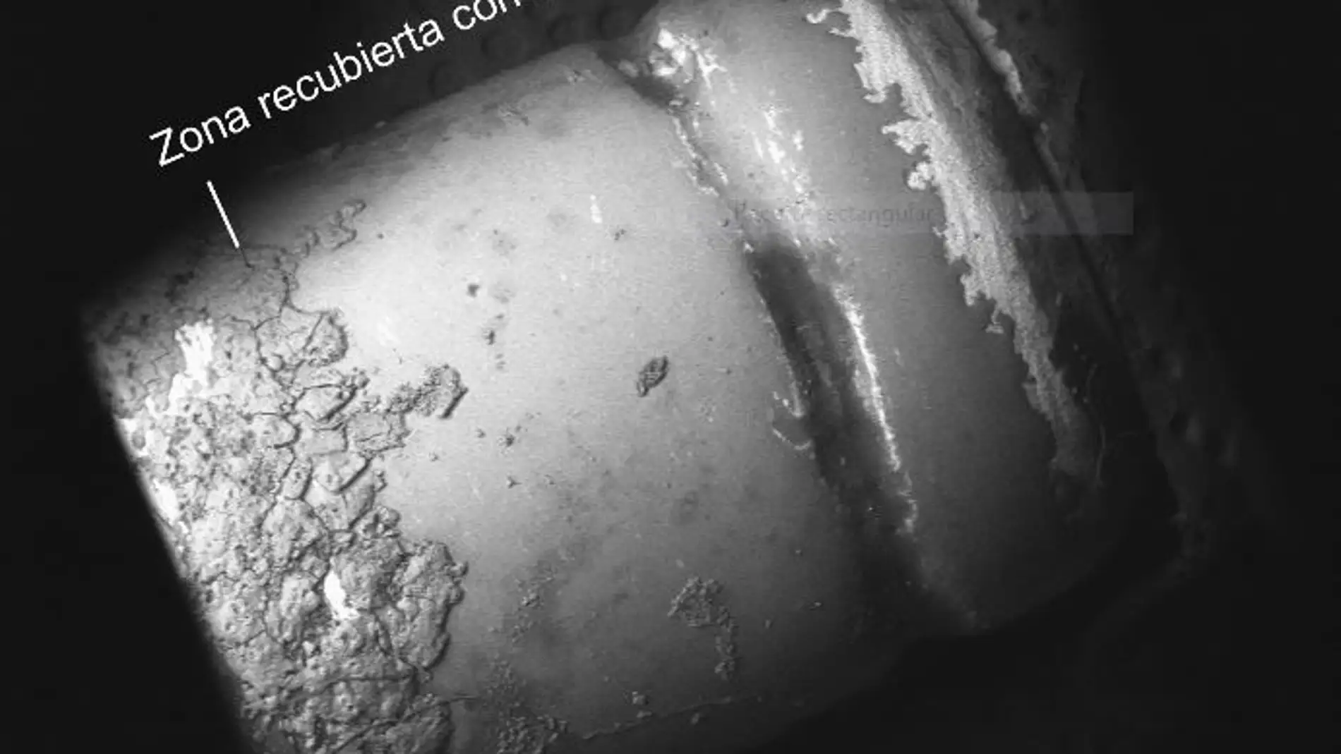 Pilar dental recubierto parcialmente por