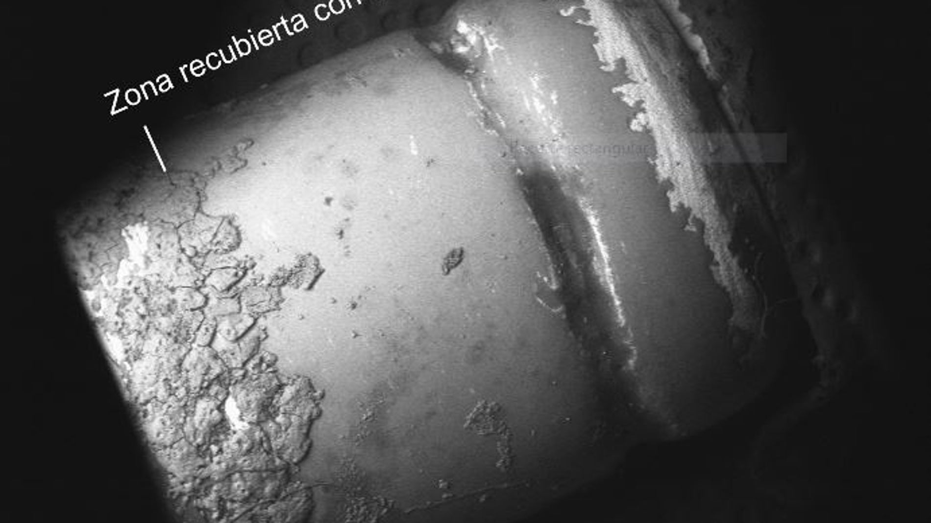 Pilar dental recubierto parcialmente por