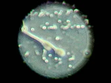 Espermatozoides Espermatozoides