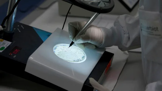 Anuncian el descubrimiento de una lombriz que transmite células cancerosas a humanos Anuncian el descubrimiento de una lombriz que transmite células cancerosas a humanos