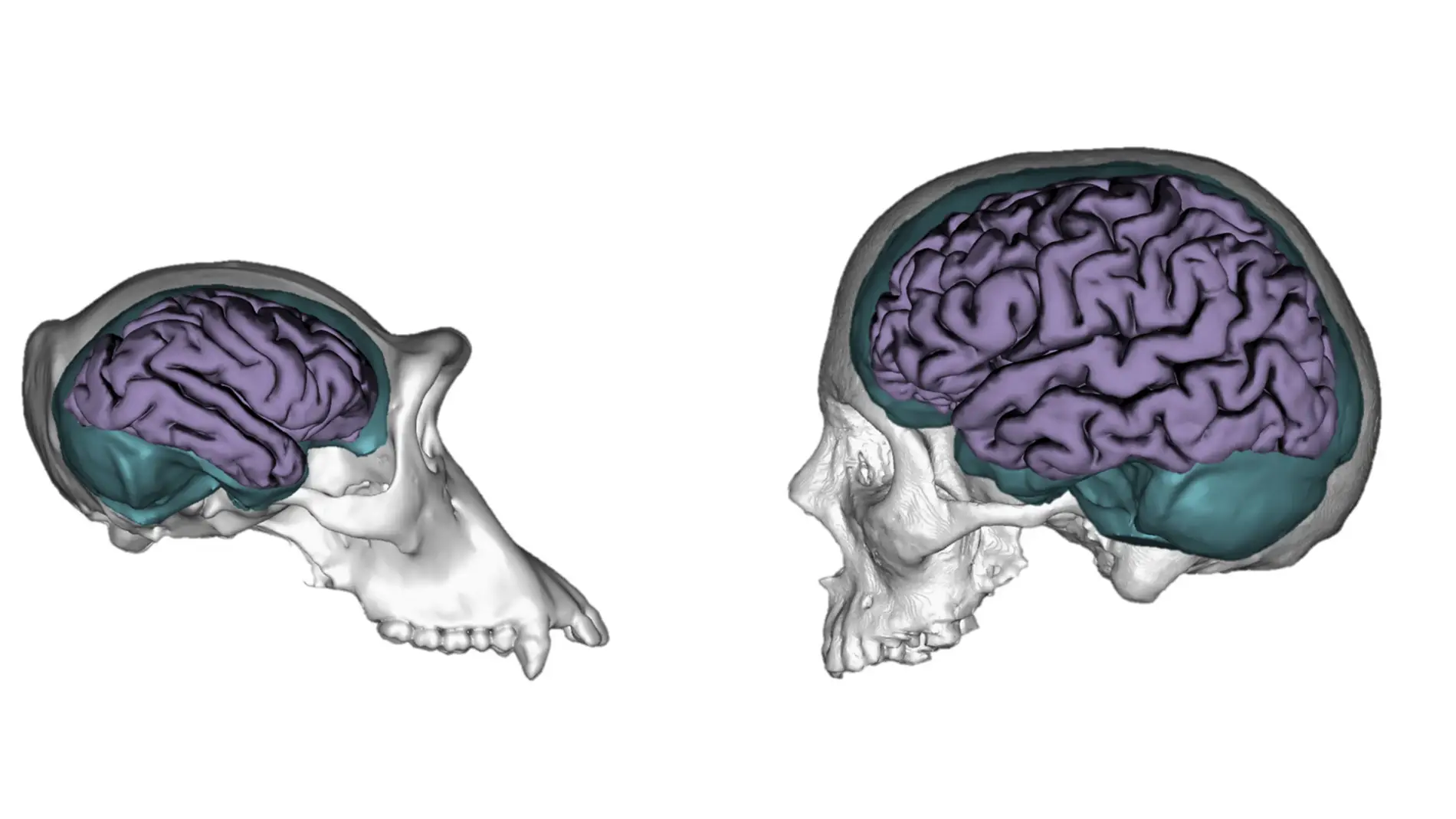 Reconstrucción tridimensional de un crán