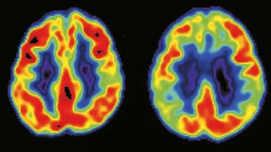 La modulación del rechazo emocional por parte del cerebro La modulación del rechazo emocional por parte del cerebro