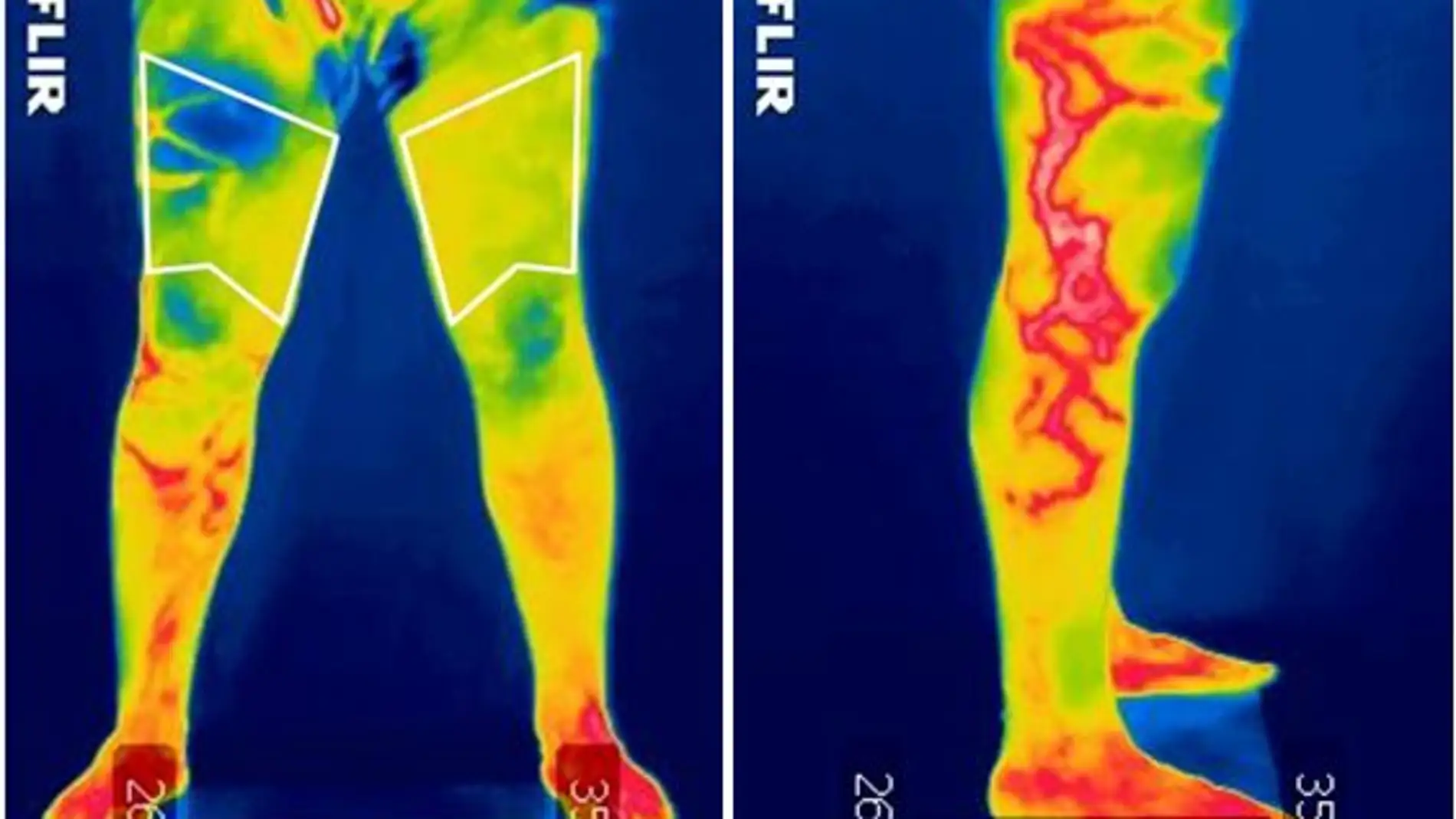 Imagen termográfica