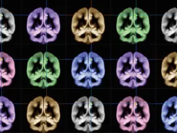 Escáner cerebral Escáner cerebral