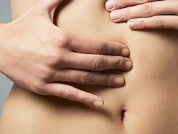 cáncer de colon cáncer de colon