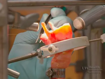Científicos crean cuerdas vocales en el laboratorio Científicos crean cuerdas vocales en el laboratorio