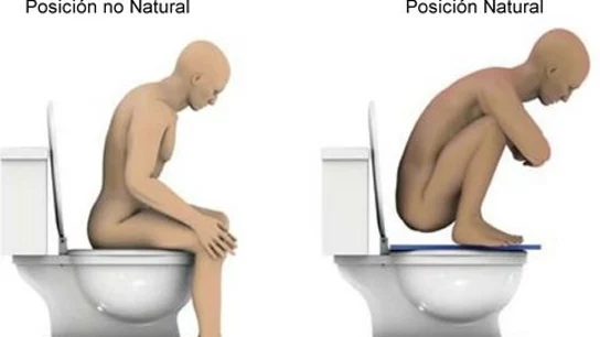 Posición correcta para hacer caca Posición correcta para hacer caca