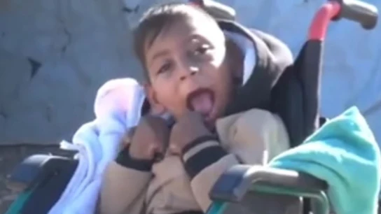 Un niño con discapacidad en Mosul Un niño con discapacidad en Mosul