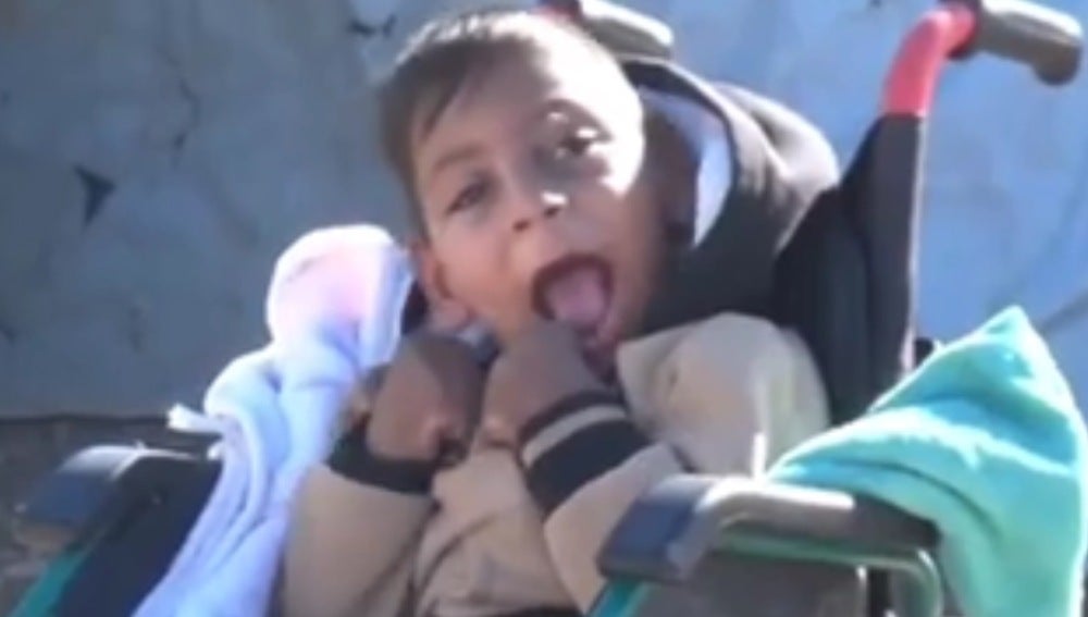 Un niño con discapacidad en Mosul