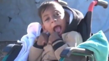 Un niño con discapacidad en Mosul
